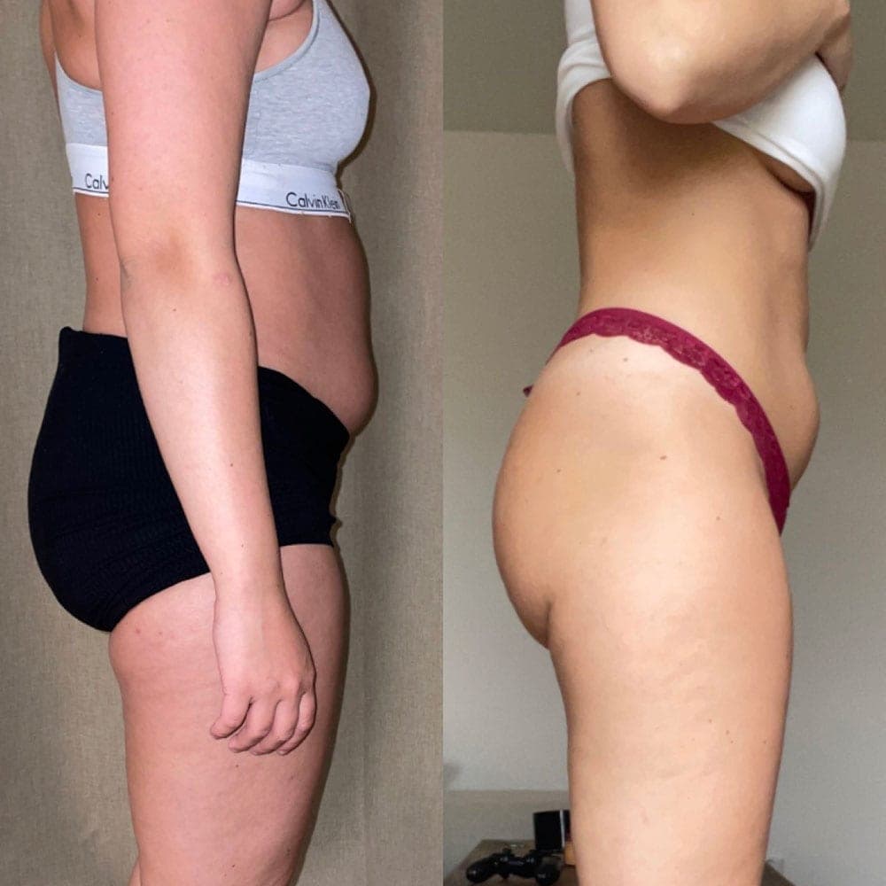 Client transformation 4 — before and after